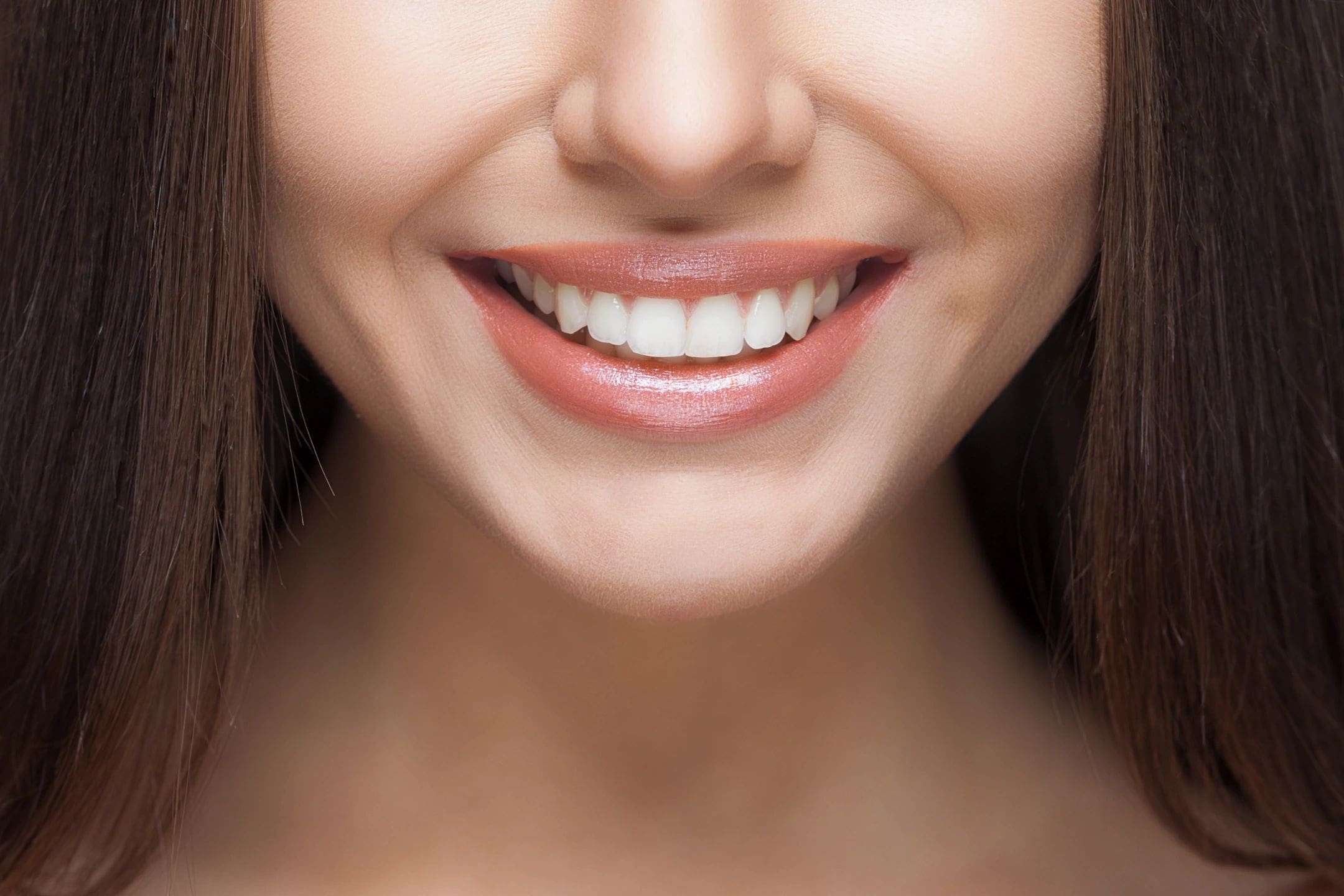 A woman with white teeth smiling for the camera.